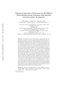 Enhanced detection of fetal pose in 3D MRI by Deep Reinforcement
  Learning with physical structure priors on anatomy