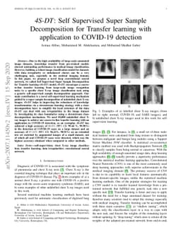 4S-DT: Self Supervised Super Sample Decomposition for Transfer learning
  with application to COVID-19 detection