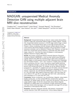 MADGAN: unsupervised Medical Anomaly Detection GAN using multiple
  adjacent brain MRI slice reconstruction