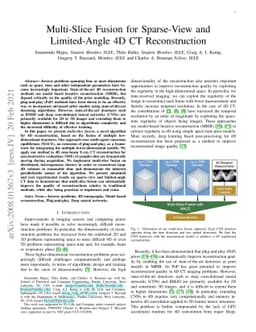 Multi-Slice Fusion for Sparse-View and Limited-Angle 4D CT
  Reconstruction