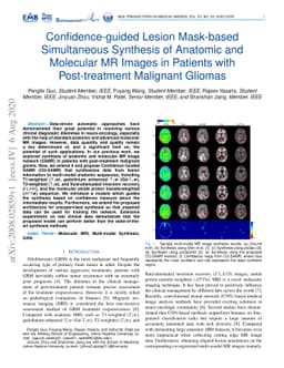 Confidence-guided Lesion Mask-based Simultaneous Synthesis of Anatomic
  and Molecular MR Images in Patients with Post-treatment Malignant Gliomas