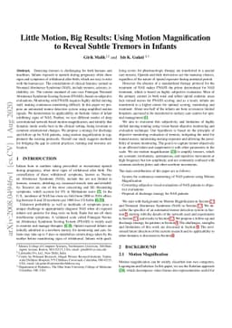 Little Motion, Big Results: Using Motion Magnification to Reveal Subtle
  Tremors in Infants