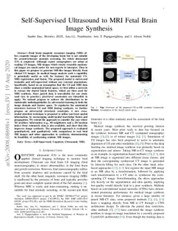 Self-Supervised Ultrasound to MRI Fetal Brain Image Synthesis