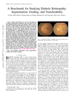 A Benchmark for Studying Diabetic Retinopathy: Segmentation, Grading,
  and Transferability