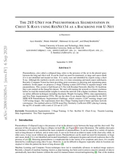 The 2ST-UNet for Pneumothorax Segmentation in Chest X-Rays using
  ResNet34 as a Backbone for U-Net