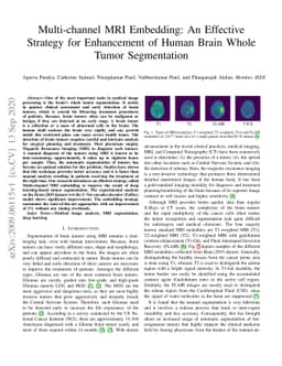 Multi-channel MRI Embedding: An EffectiveStrategy for Enhancement of
  Human Brain WholeTumor Segmentation