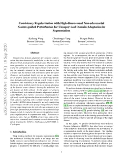 Consistency Regularization with High-dimensional Non-adversarial
  Source-guided Perturbation for Unsupervised Domain Adaptation in Segmentation