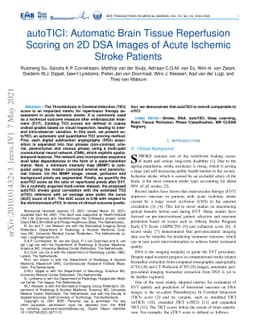 autoTICI: Automatic Brain Tissue Reperfusion Scoring on 2D DSA Images of
  Acute Ischemic Stroke Patients