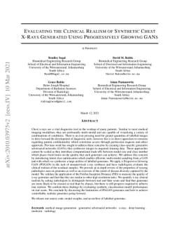 Evaluating the Clinical Realism of Synthetic Chest X-Rays Generated
  Using Progressively Growing GANs