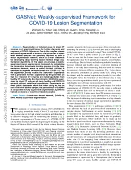 GASNet: Weakly-supervised Framework for COVID-19 Lesion Segmentation