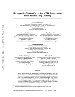 Retrospective Motion Correction of MR Images using Prior-Assisted Deep
  Learning