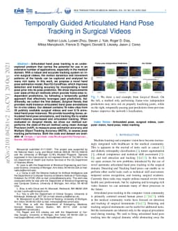 Temporally Guided Articulated Hand Pose Tracking in Surgical Videos