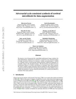 Adversarial cycle-consistent synthesis of cerebral microbleeds for data
  augmentation
