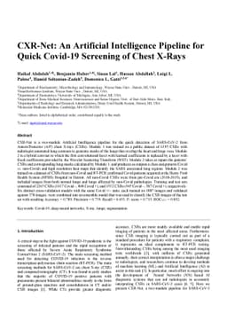 CXR-Net: An Artificial Intelligence Pipeline for Quick Covid-19
  Screening of Chest X-Rays
