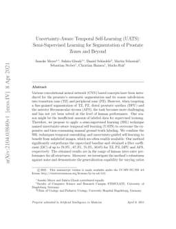 Uncertainty-Aware Temporal Self-Learning (UATS): Semi-Supervised
  Learning for Segmentation of Prostate Zones and Beyond