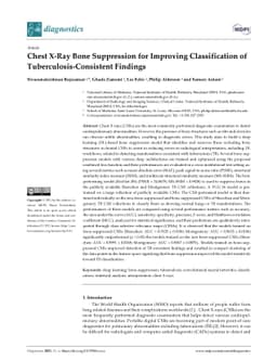 Chest X-Ray Bone Suppression for Improving Classification of
  Tuberculosis-Consistent Findings