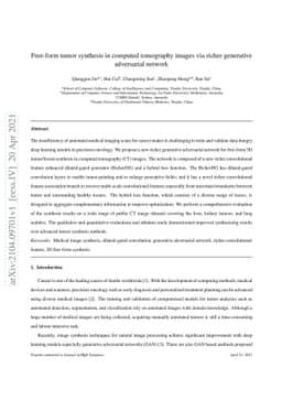 Free-form tumor synthesis in computed tomography images via richer
  generative adversarial network