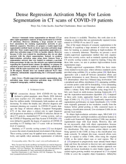 Dense Regression Activation Maps For Lesion Segmentation in CT scans of
  COVID-19 patients
