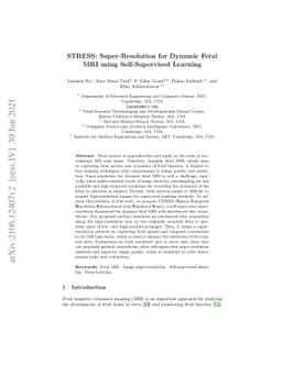 STRESS: Super-Resolution for Dynamic Fetal MRI using Self-Supervised
  Learning