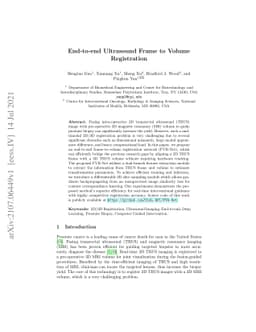 End-to-end Ultrasound Frame to Volume Registration