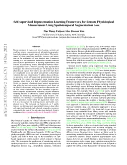 Self-supervised Representation Learning Framework for Remote
  Physiological Measurement Using Spatiotemporal Augmentation Loss