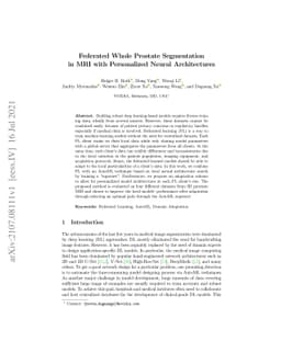 Federated Whole Prostate Segmentation in MRI with Personalized Neural
  Architectures