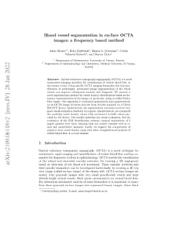 Blood vessel segmentation in en-face OCTA images: a frequency based
  method