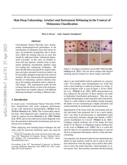 Skin Deep Unlearning: Artefact and Instrument Debiasing in the Context
  of Melanoma Classification