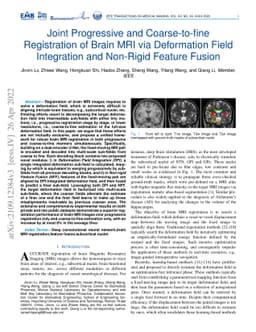 Joint Progressive and Coarse-to-fine Registration of Brain MRI via
  Deformation Field Integration and Non-Rigid Feature Fusion