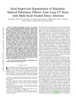 Semi-Supervised Segmentation of Radiation-Induced Pulmonary Fibrosis
  from Lung CT Scans with Multi-Scale Guided Dense Attention