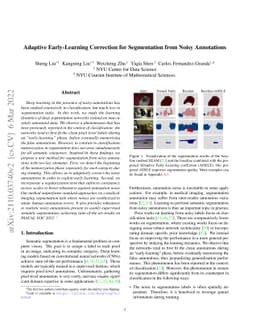 Adaptive Early-Learning Correction for Segmentation from Noisy
  Annotations
