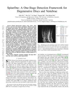 SpineOne: A One-Stage Detection Framework for Degenerative Discs and
  Vertebrae