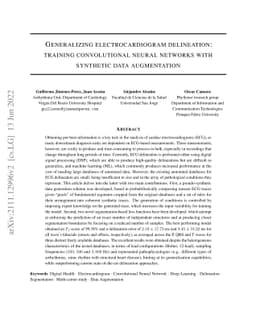 Generalizing electrocardiogram delineation -- Training convolutional
  neural networks with synthetic data augmentation