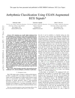 Arrhythmia Classification using CGAN-augmented ECG Signals