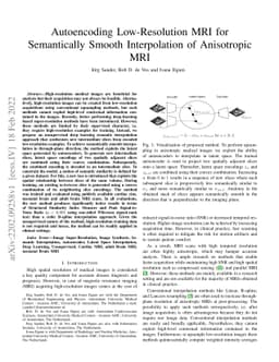 Autoencoding Low-Resolution MRI for Semantically Smooth Interpolation of
  Anisotropic MRI