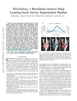 NaviAirway: a Bronchiole-sensitive Deep Learning-based Airway
  Segmentation Pipeline