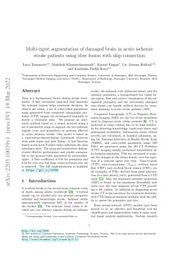 Multi-input segmentation of damaged brain in acute ischemic stroke
  patients using slow fusion with skip connection