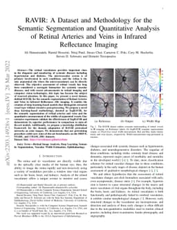 RAVIR: A Dataset and Methodology for the Semantic Segmentation and
  Quantitative Analysis of Retinal Arteries and Veins in Infrared Reflectance
  Imaging