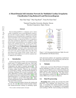 A Mixed-Domain Self-Attention Network for Multilabel Cardiac
  Irregularity Classification Using Reduced-Lead Electrocardiogram