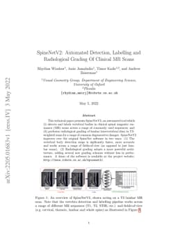 SpineNetV2: Automated Detection, Labelling and Radiological Grading Of
  Clinical MR Scans