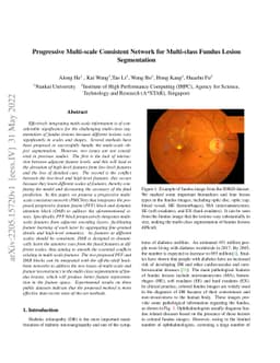 Progressive Multi-scale Consistent Network for Multi-class Fundus Lesion
  Segmentation