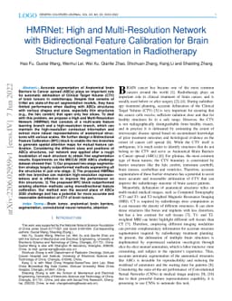 HMRNet: High and Multi-Resolution Network with Bidirectional Feature
  Calibration for Brain Structure Segmentation in Radiotherapy