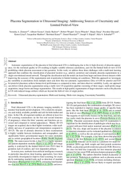 Placenta Segmentation in Ultrasound Imaging: Addressing Sources of
  Uncertainty and Limited Field-of-View