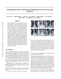 CheXplaining in Style: Counterfactual Explanations for Chest X-rays
  using StyleGAN