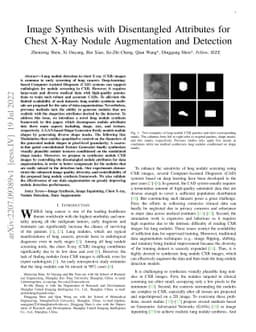 Image Synthesis with Disentangled Attributes for Chest X-Ray Nodule
  Augmentation and Detection