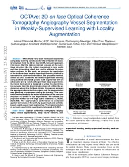 OCTAve: 2D en face Optical Coherence Tomography Angiography Vessel
  Segmentation in Weakly-Supervised Learning with Locality Augmentation