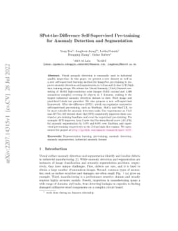 SPot-the-Difference Self-Supervised Pre-training for Anomaly Detection
  and Segmentation