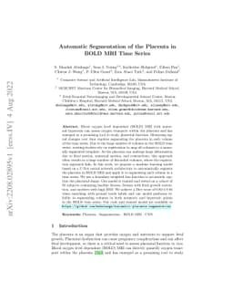 Automatic Segmentation of the Placenta in BOLD MRI Time Series
