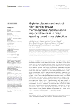 High-resolution synthesis of high-density breast mammograms: Application
  to improved fairness in deep learning based mass detection