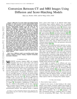 Conversion Between CT and MRI Images Using Diffusion and Score-Matching
  Models
